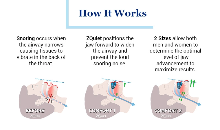 How It Works Image